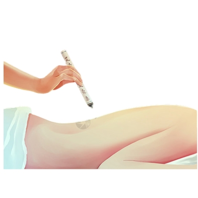 Long Shelf Life Smokeless Moxibustion Stick for Traditional Chinese Medicine Therapy